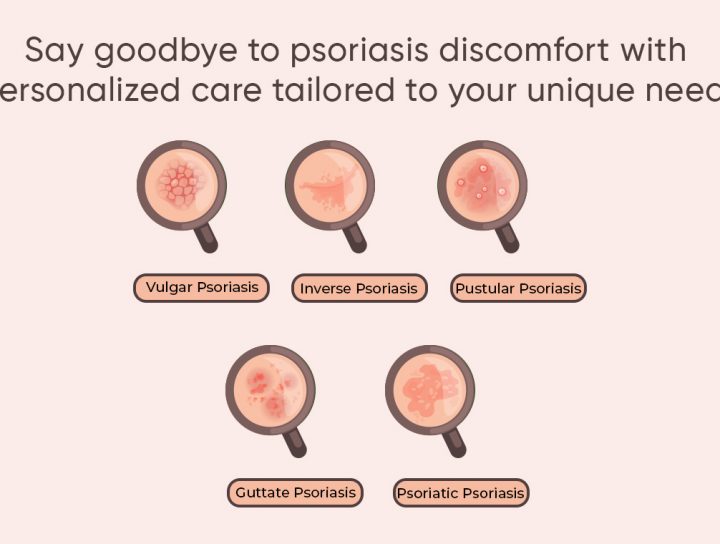 Homeopathic Remedies For Psoriasis